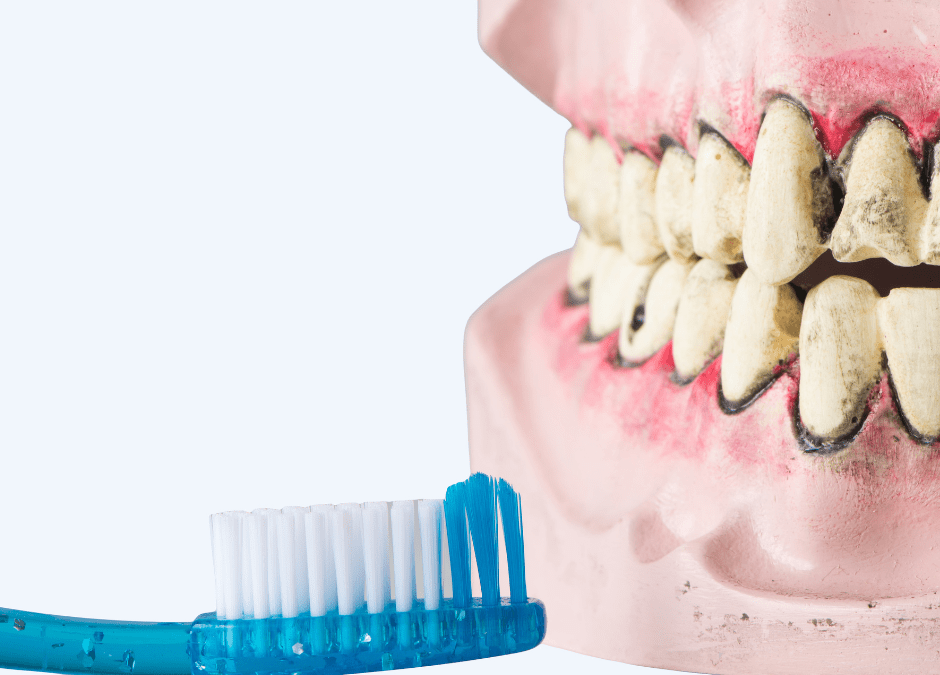 Potential Side Effects of Poor Dental Health